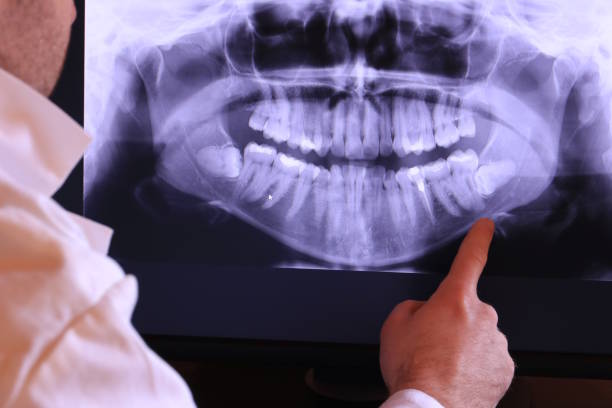 Best Emergency Dentist for Knocked-Out Tooth in Manassas Park, VA
