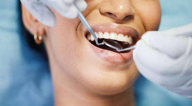Best Emergency Dentist for Lost Fillings or Crowns in Manassas Park, VA